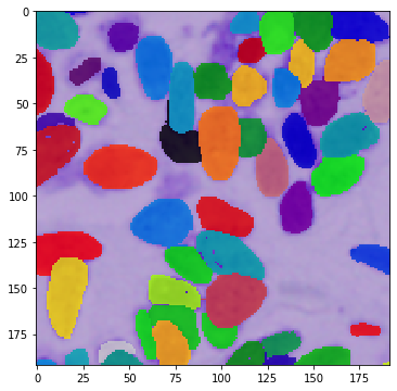 _images/DSBowl18_segmentation_9_3.png