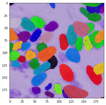 _images/DSBowl18_segmentation_9_4.png