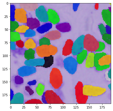 _images/DSBowl18_segmentation_9_5.png