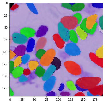 _images/DSBowl18_segmentation_9_8.png