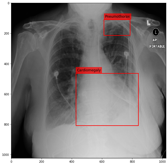 _images/Medical_Data_Augmentation_CXR14_10_0.png