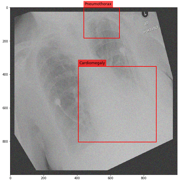 _images/Medical_Data_Augmentation_CXR14_22_1.png