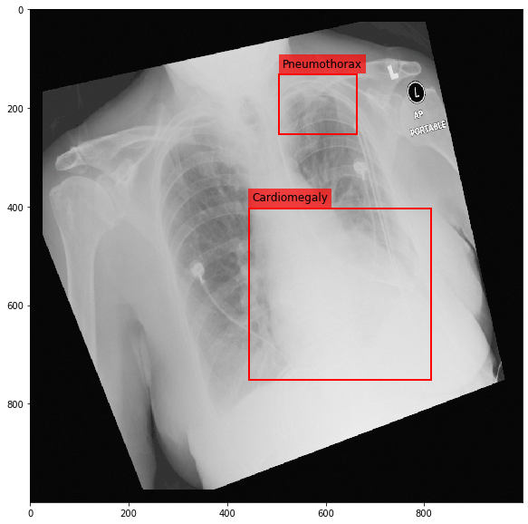 _images/Medical_Data_Augmentation_CXR14_22_2.png