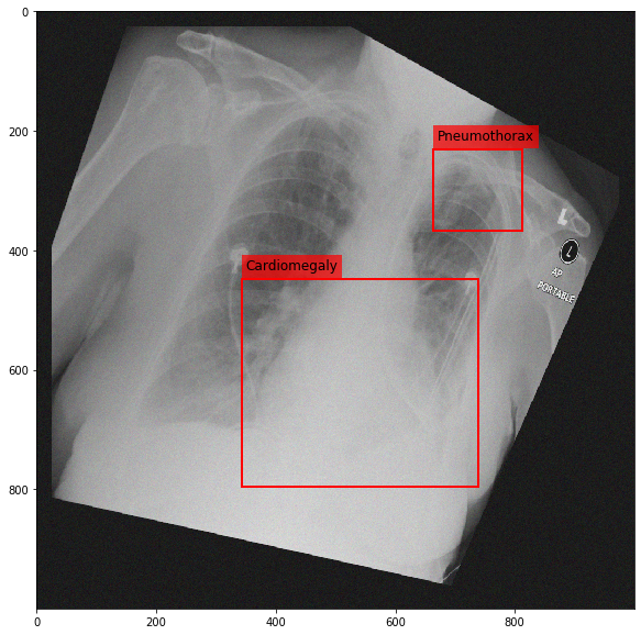 _images/Medical_Data_Augmentation_CXR14_22_3.png