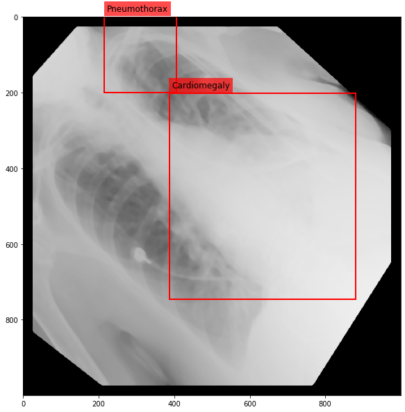 _images/Medical_Data_Augmentation_CXR14_22_7.png